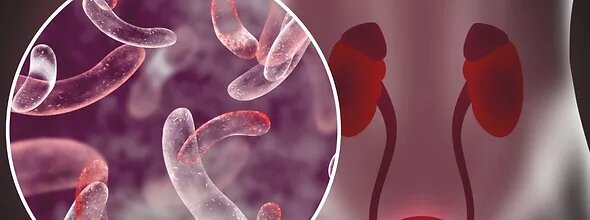Understanding-and-Treating-Urinary-Tract-Infections-(UTIs)